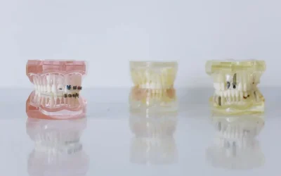 15 Comfort Braces Facts You Should Know