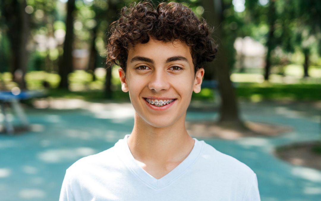 How Long Do I Have to Wear Braces? Timeline for St. Augustine Patients